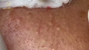 Relax New Day With Loan Nguyen Spa #020