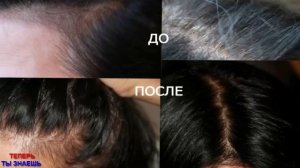 Как ИЗБАВИТЬСЯ От СЕДЫХ Волос С ПОМОЩЬЮ Народных СРЕДСТВ