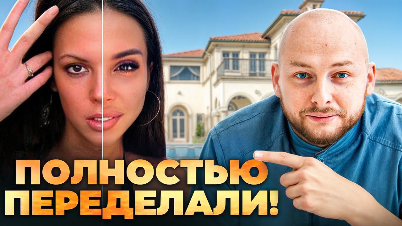 Что Самойлова делает у косметолога? Разбор пластики.
