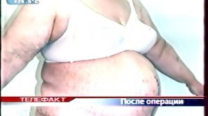 Челябинск Медицина Пластическая хирургия Пухов 1ый эпизод Год 2009