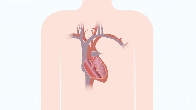 05 Кардиологические устройства смотреть онлайн