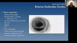 Trauma Ocular Penetrante; Córnea, Iris y Cristalino