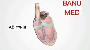 АВ БЛОКАДА . МОБИТЦ 1 , МОБИТЦ 2