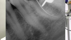 DentalПлюшки 35 - файлы SOCO SC Pro