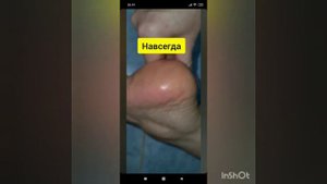 Вас мучают проблемы с сухостью ступней ног?