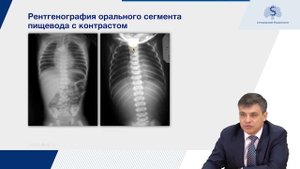 Атрезия пищевода
