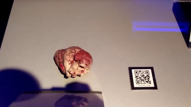 Выставка анатомических тел на ВДНХ. Почему СК начал проверку? Анатомия смотреть онлайн