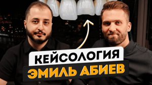Эмиль Абиев - Реставрация центрального резца 21 | Фронтальная реставрация | кейсология