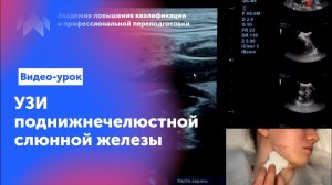 Узи для начинающих. Урок "УЗИ поднижнечелюстной слюнной железы"