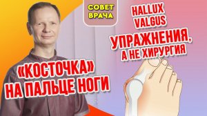 Упражнения от шишки на ноге или вальгусная стопа.