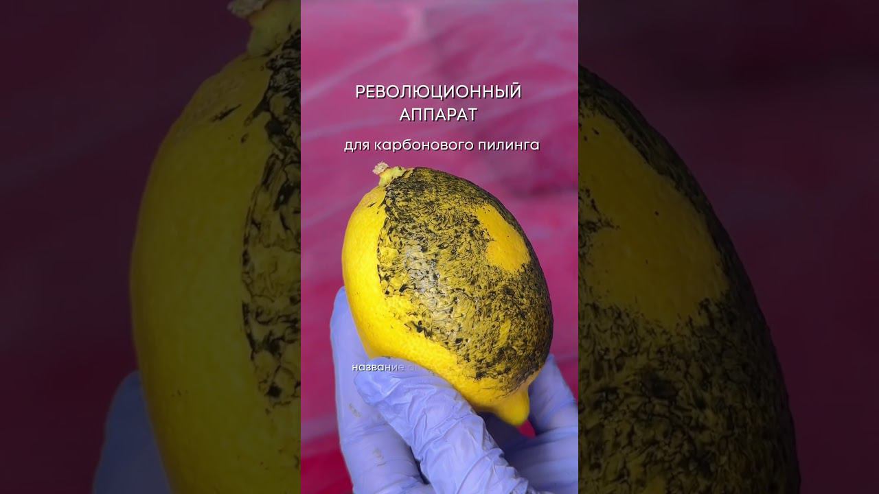 Лучшая модель для карбонового пилинга!  #косметология #доктор #красота #тренды #карбоновыйпилинг
