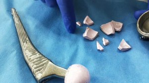 Best Implant for Hip Replacement ??