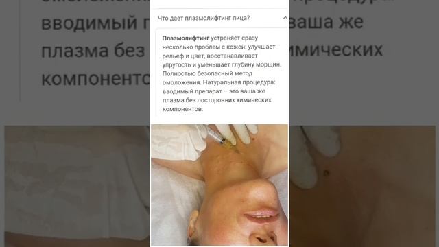 Плазмолифтинг описание 1 смотреть онлайн