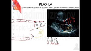 ЭхоКГ  Аккредсценарий №1  Введение  Часть 2