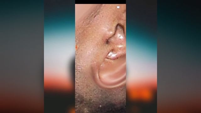 Face Smooth And Glow// Smooth Face Tutorial // Lucky vi photograpy // Mobile Tutorial