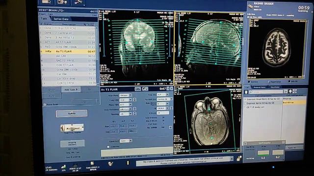 Brain MRI scan protocols, positioning and planning