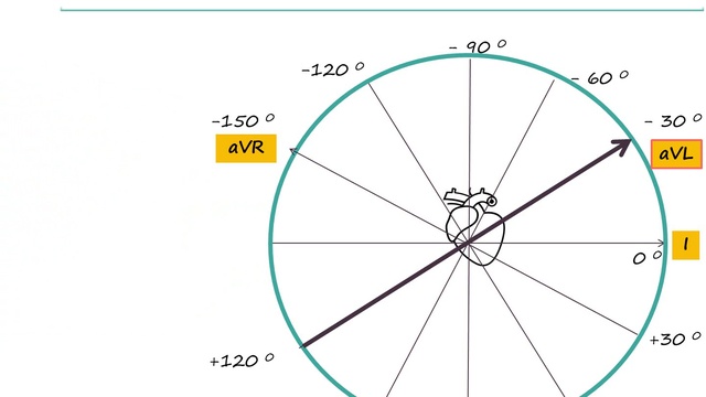 Опред. ЭОС (эл. оси сердца) по ЭКГ смотреть онлайн