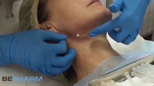 Коррекция второго подбородка и шейно-подбородочного угла спиральными мезонитями INTRARICH