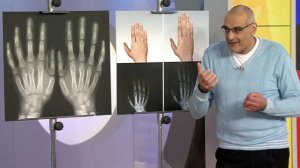 Жить здорово! Выпуск от 02.09.2013