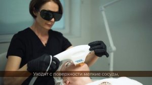 BBL-терапия (Фотоомоложение BBL Forever Young)