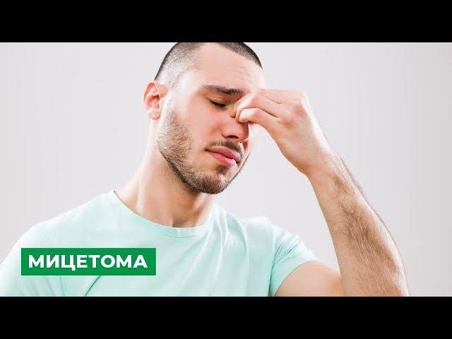 Мицетома