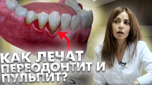 Как лечили пульпит/периодонтит раньше и как его лечат сейчас?