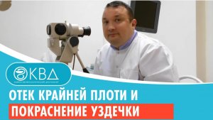 ? Отек крайней плоти и покраснение уздечки. Клинический случай №644