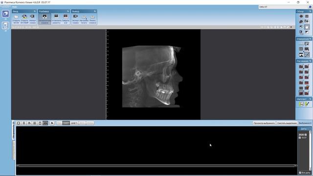 Возможности программы Romexis Viewer: выведение реформата ТРГ смотреть онлайн