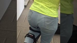 Ты можешь ходить с травмированным голеностопом - девушка делает первые шаги на iwalk 2.0