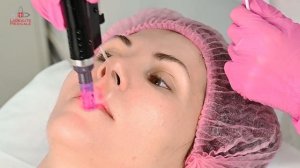 Жидкий лазер "Skintex-Атласная кожа"