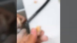 Металлокерамические мостовидные протезы