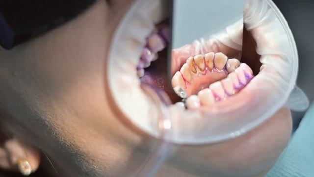 Профилактика заболеваний полости рта в стоматологии "Максима" в Смоленске смотреть онлайн