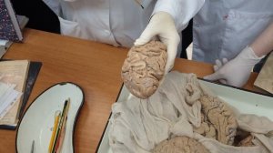 1.1 Конечный мозг: анатомия коры, локализация корковых анализаторов
