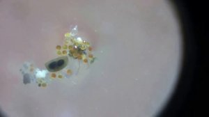 Попытка получение живой дафнии из заморозки (3)