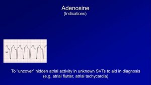 Antiarrhythmics (Lesson 6 - Digoxin, Adenosine, Atropine, Isoproterenol, and Ivabradine)