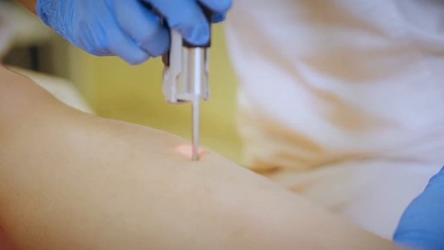 Лазерная эпиляция Элит+ смотреть онлайн