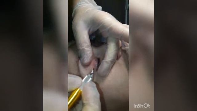 Микроблейдинг межресничного края. Стрелочки !!!
