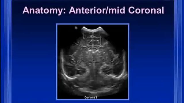 Нейросонография. Часть 1 смотреть онлайн