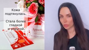 Отзыв пациента о процедуре микроигольчатый RF лифтинг