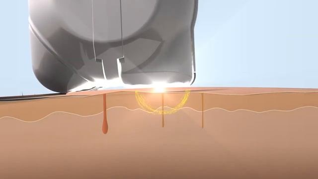 elos epi 1280x720 смотреть онлайн