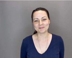 Блефаропластика: неделя после операции.