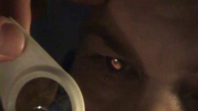 Зеркальная офтальмоскопия смотреть онлайн