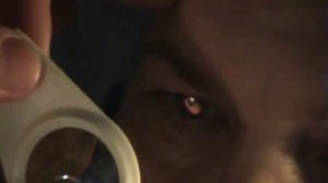 Зеркальная офтальмоскопия