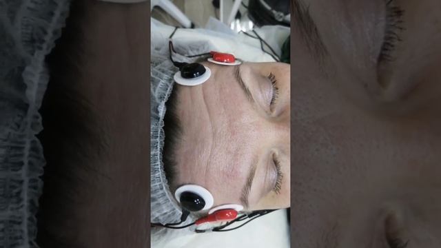 Миостимуляция лица. Рассказывает врач-косметолог МЦ "Арктика" Гузеева Екатерина Владимировна