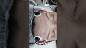 Миостимуляция лица. Рассказывает врач-косметолог МЦ "Арктика" Гузеева Екатерина Владимировна