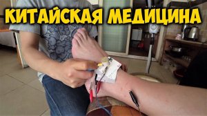 ИГЛОУКАЛЫВАНИЕ  В КИТАЕ. НЕТРАДИЦИОННАЯ КИТАЙСКАЯ МЕДИЦИНА. ВИКТОР ПОДВЕРНУЛ НОГУ.