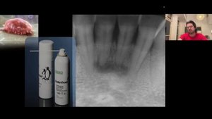 Бесплатный вебинар Михаила Соломонова. O чем не думают стоматологи