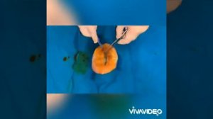 Первичная хирургическая обработка раны