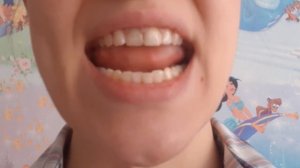 Упражнение дятел. Артикуляционная гимнастика. Занятие с логопедом.