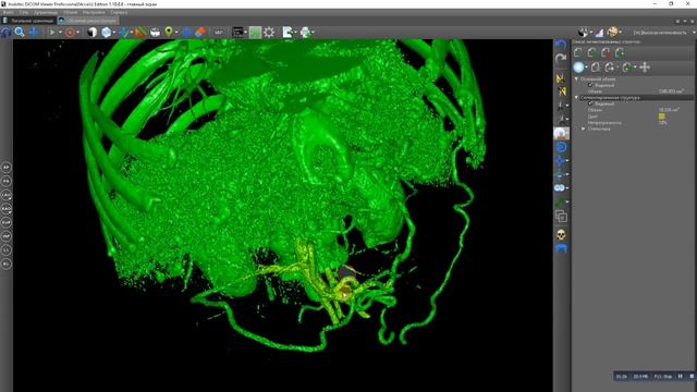 Segmentation by mask in 3D